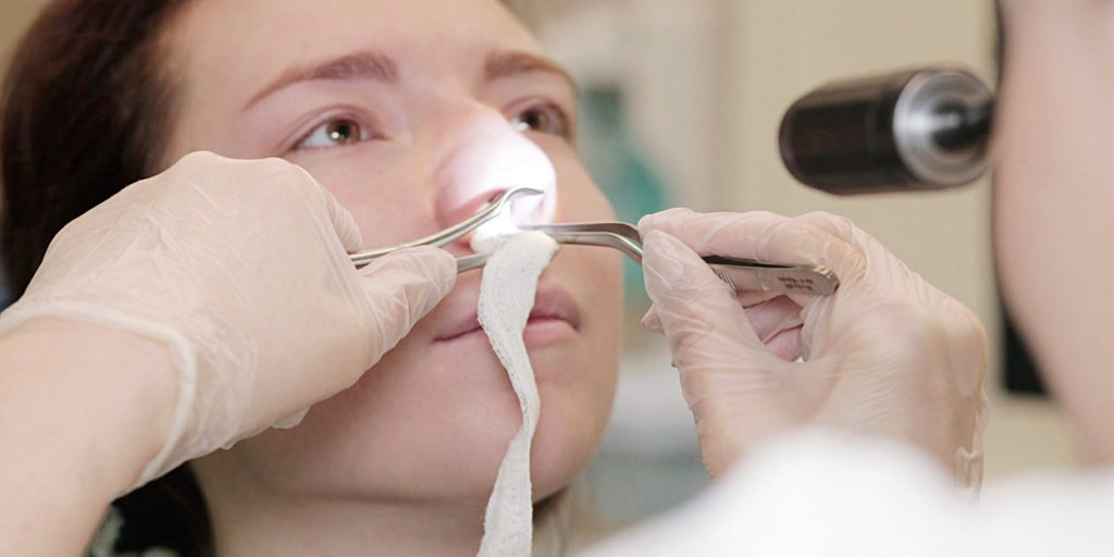 Лікування носових кровотеч